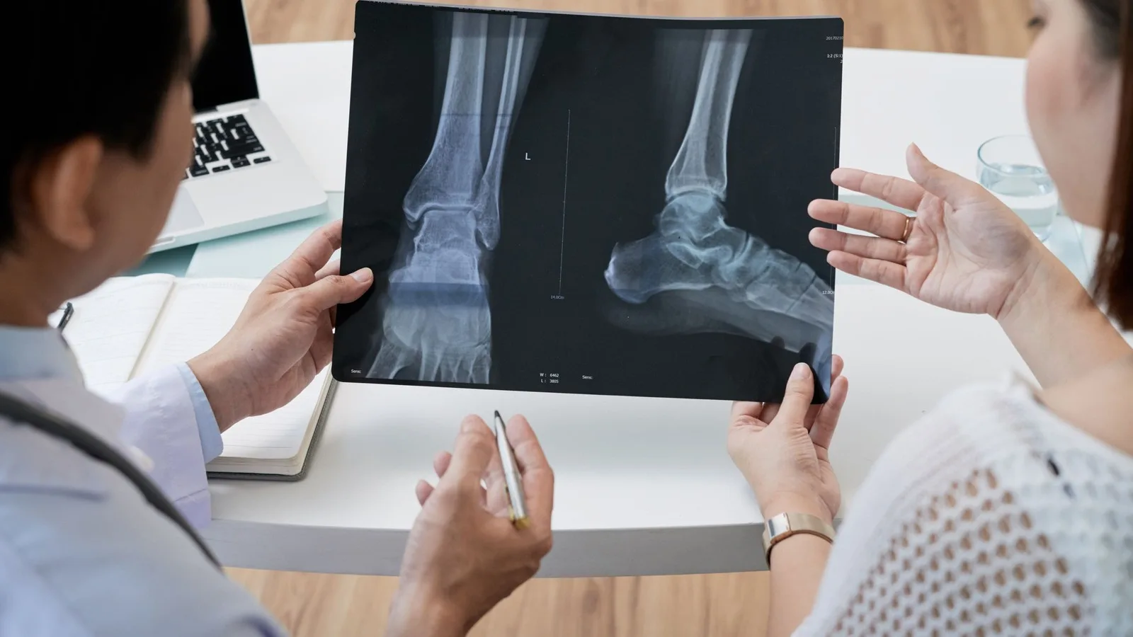 Tratamiento especializado de fracturas en Michoacán